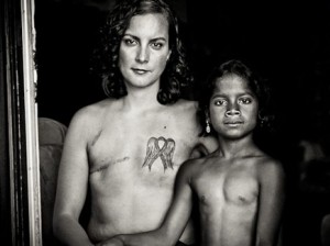 Photo: David Jay/The SCAR Project (www.thescarproject.org)
